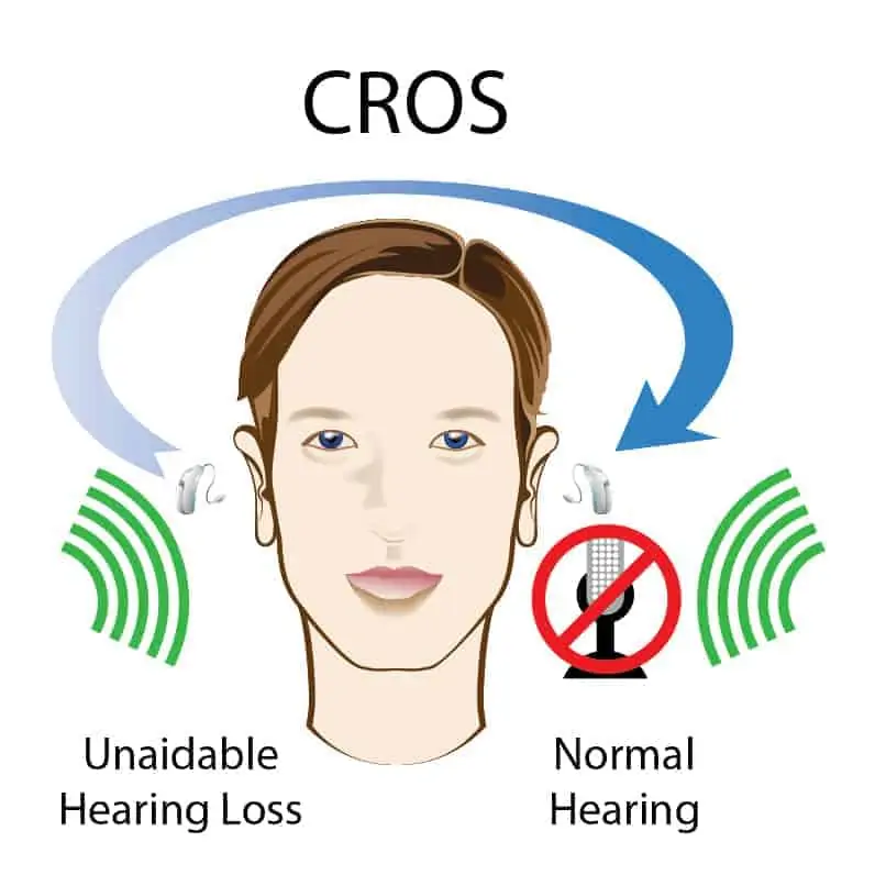 CROS Hearing Aid Illustration